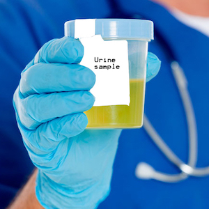 Urinanalyser, Organisk syretest, UriPep
